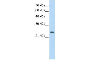 WB Suggested Anti-TSHR Antibody Titration:  0. (TSH receptor Antikörper  (C-Term))