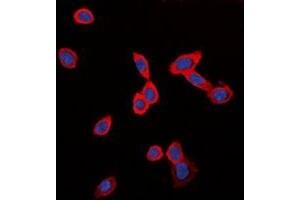 Immunofluorescent analysis of GPR126 staining in LOVO cells. (G Protein-Coupled Receptor 126 Antikörper)