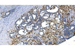 IHC analysis of GCHFR using anti-GCHFR antibody (ABIN7600511).