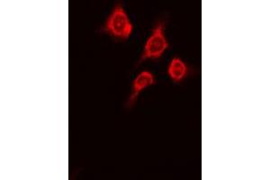ABIN6269362 staining A431 cells by IF/ICC.