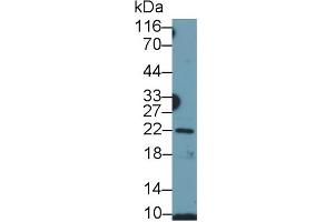 Detection of GH in Human Placenta lysate using Polyclonal Antibody to Growth Hormone (GH) (Growth Hormone 1 Antikörper  (AA 28-217))