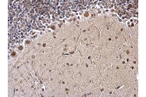 Immunohistochemistry (IHC) image for anti-Far Upstream Element (FUSE) Binding Protein 1 (FUBP1) antibody (ABIN2855856)