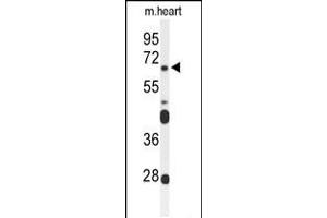 Western blot analysis of FZD4 Antibody in mouse heart tissue lysates (35ug/lane) (FZD4 Antikörper  (C-Term))
