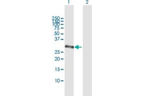 CSGALNACT1 antibody  (AA 1-297)