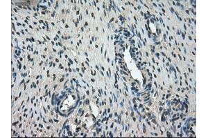 Immunohistochemical staining of paraffin-embedded Ovary tissue using anti-FERMT2mouse monoclonal antibody. (FERMT2 Antikörper)