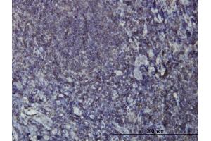 Immunoperoxidase of monoclonal antibody to EPHB3 on formalin-fixed paraffin-embedded human tonsil. (EPH Receptor B3 Antikörper  (AA 899-997))