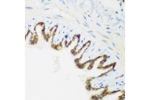 Immunohistochemistry of paraffin-embedded rat lung using KIAA1456 antibody (ABIN5974326) at dilution of 1/200 (40x lens). (KIAA1456 Antikörper)