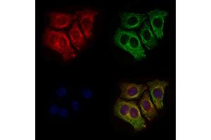 ABIN6258402 and ABIN6275699 staining HepG2 cells by IF/ICC.