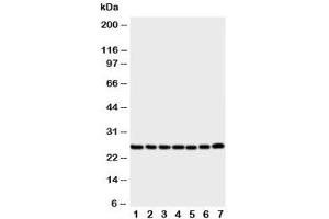 Western blot testing of SIP antibody and Lane 1:  rat liver (CACYBP Antikörper  (Middle Region))