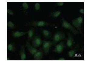 Immunostaining analysis in HeLa cells. (NR4A1 Antikörper)