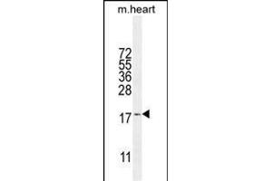 SNR27 Antibody (Center) (ABIN655835 and ABIN2845250) western blot analysis in mouse heart tissue lysates (35 μg/lane). (SNRNP27 Antikörper  (AA 69-98))