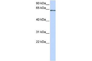 WB Suggested Anti-RELA Antibody Titration:  0. (NF-kB p65 Antikörper  (Middle Region))