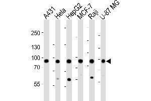 Western blot analysis of lysates from A431, Hela, HepG2, MCF-7, Raji, U-87 MG cell line (from left to right), using IT Antibody (Center) (ABIN6242975 and ABIN6577493). (IMMT Antikörper  (AA 170-203))