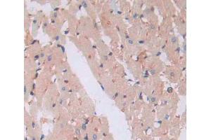 Used in DAB staining on fromalin fixed paraffin- embedded heart tissue (PLA2G3 Antikörper  (AA 20-268))