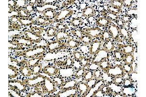 Formalin-fixed and paraffin embedded rat kidney tissue labeled with Anti-Claudin 5 Polyclonal Antibody, Unconjugated (ABIN673869) followed by conjugation to the secondary antibody and DAB staining (Claudin 5 Antikörper)
