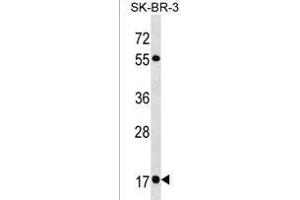 RAB19 Antibody (N-term) (ABIN1538880 and ABIN2850090) western blot analysis in SK-BR-3 cell line lysates (35 μg/lane). (RAB19 Antikörper  (N-Term))