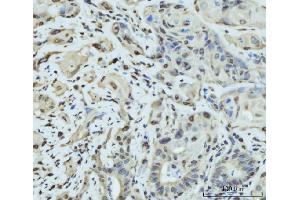 IHC analysis of SCP3/SYCP3 using anti-SCP3/SYCP3 antibody (ABIN7602415). (SYCP3 Antikörper  (AA 75-236))