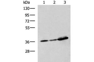 Western blot analysis of A549 A172 and HepG2 cell lysates using EEF1D Polyclonal Antibody at dilution of 1:950 (EEF1D Antikörper)