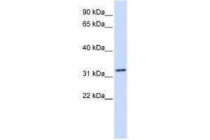 Tropomyosin 1 antibody used at 1 ug/ml to detect target protein. (Tropomyosin Antikörper)