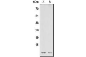Western blot analysis of NDUFA3 expression in HEK293T (A), Raw264. (NDUFA3 Antikörper  (Center))