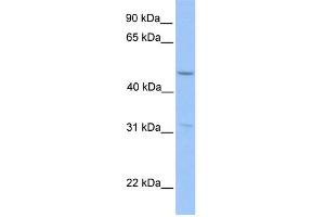 WB Suggested Anti-ZNF342 Antibody Titration:  0. (Zinc Finger Protein 296 (ZNF296) (Middle Region) Antikörper)