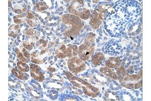 CD36 antibody was used for immunohistochemistry at a concentration of 4-8 ug/ml. (CD36 Antikörper)