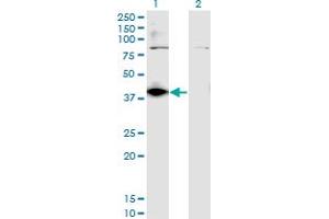 Western Blot analysis of DHDH expression in transfected 293T cell line by DHDH monoclonal antibody (M03), clone 3A11. (DHDH Antikörper  (AA 235-334))