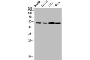 Western blot analysis of HepG2 JK Colo Hela using TRMT11 antibody.