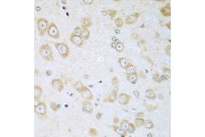 Immunohistochemistry of paraffin-embedded mouse brain using ACOX1 antibody at dilution of 1:100 (40x lens). (ACOX1 Antikörper)