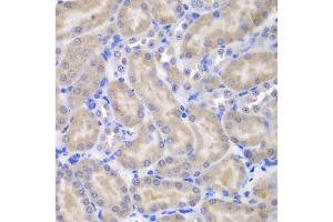 Immunohistochemistry of paraffin-embedded mouse kidney using ASPSCR1 antibody (ABIN5975297) at dilution of 1/100 (40x lens). (ASPSCR1 Antikörper)