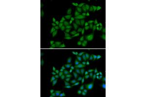 Immunofluorescence analysis of HeLa cell using BLZF1 antibody. (BLZF1 Antikörper)