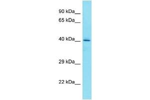 Host: Rabbit Target Name: FAM203A Sample Type: HepG2 Whole Cell lysates Antibody Dilution: 1. (FAM203B Antikörper  (C-Term))