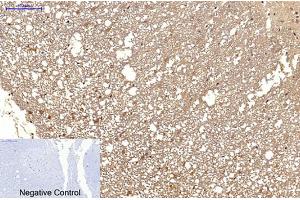 Immunohistochemical analysis of paraffin-embedded rat spinal cord tissue. (MICU1 Antikörper)