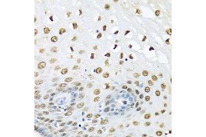Immunohistochemistry of paraffin-embedded human liver using UBC antibody. (UBC Antikörper  (AA 1-100))