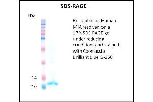 SDS-PAGE (SDS) image for Melanoma Inhibitory Activity (MIA) (Active) protein (ABIN5509521)