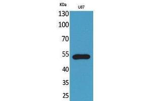 Western Blotting (WB) image for anti-Chemokine (C-X3-C Motif) Receptor 1 (CX3CR1) (Internal Region) antibody (ABIN3178143) (CX3CR1 Antikörper  (Internal Region))