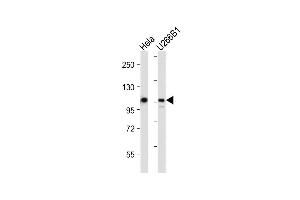 All lanes : Anti-GEN1 Antibody (N-term) at 1:2000 dilution Lane 1: Hela whole cell lysate Lane 2: U266B1 whole cell lysate Lysates/proteins at 20 μg per lane. (GEN1 Antikörper  (N-Term))