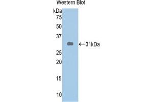 Western Blotting (WB) image for anti-ATP-Binding Cassette, Sub-Family A (ABC1), Member 1 (ABCA1) (AA 1404-1663) antibody (ABIN7433312)