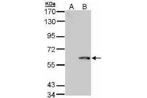 WB Image Western Blot analysis of FPGS expression in transfected 293T cell line by FPGS polyclonal antibody. (FPGS Antikörper)