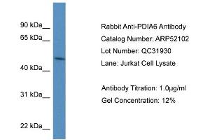 WB Suggested Anti-PDIA6 Antibody Titration: 0. (PDIA6 Antikörper  (N-Term))