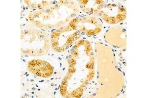 Immunohistochemistry of paraffin embedded human kidney using CYP20A1 (ABIN7073675) at dilution of 1: 700 (400x lens) (CYP20A1 Antikörper)