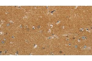 Immunohistochemistry of paraffin-embedded Human brain using GJB6 Polyclonal Antibody at dilution of 1:30 (GJB6 Antikörper)