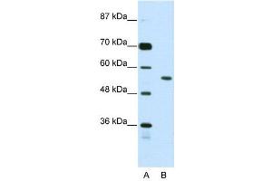 Western Blotting (WB) image for anti-Bromodomain Containing 3 (BRD3) (N-Term) antibody (ABIN2780846)