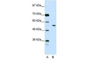 WB Suggested Anti-BRD3  Antibody Titration: 2. (BRD3 Antikörper  (N-Term))