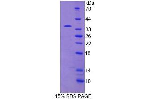Image no. 1 for phosphodiesterase 4B, cAMP-Specific (PDE4B) (AA 500-736) protein (His tag) (ABIN4990450) (PDE4B Protein (AA 500-736) (His tag))