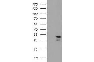 Western Blotting (WB) image for anti-RASD Family, Member 2 (RASD2) antibody (ABIN1500696) (RASD2 Antikörper)