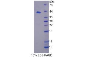 SDS-PAGE analysis of Mouse NCOR1 Protein. (NCOR1 Protein)