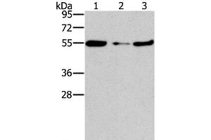 Western Blot analysis of Mouse heart tissue and NIH/3T3 cell, Mouse liver tissue using FGFR1OP Polyclonal Antibody at dilution of 1:850 (FGFR1OP Antikörper)