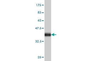 Western Blot detection against Immunogen (36. (EPH Receptor B3 Antikörper  (AA 899-997))