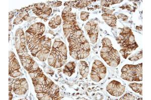 IHC-P Image Immunohistochemical analysis of paraffin-embedded human stomach, using ELMO1, antibody at 1:100 dilution.